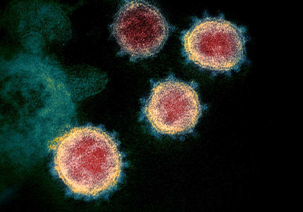 Novel_Coronavirus_SARS-CoV-2