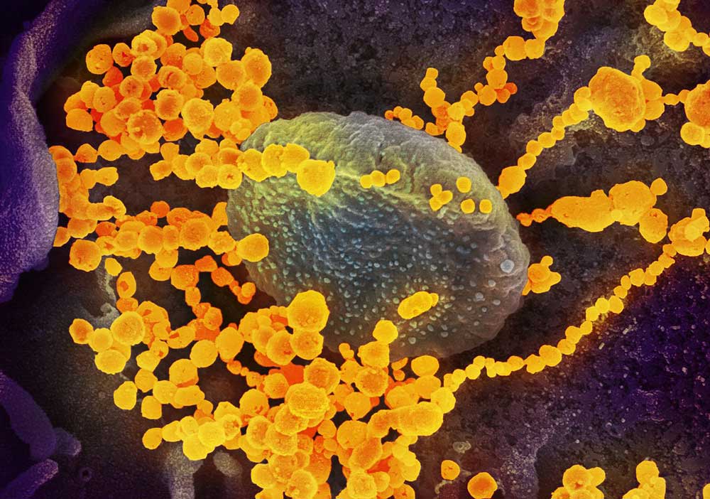 SARS-CoV-2_microscope_image