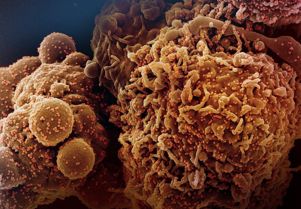 coronavirus-omicron-variant