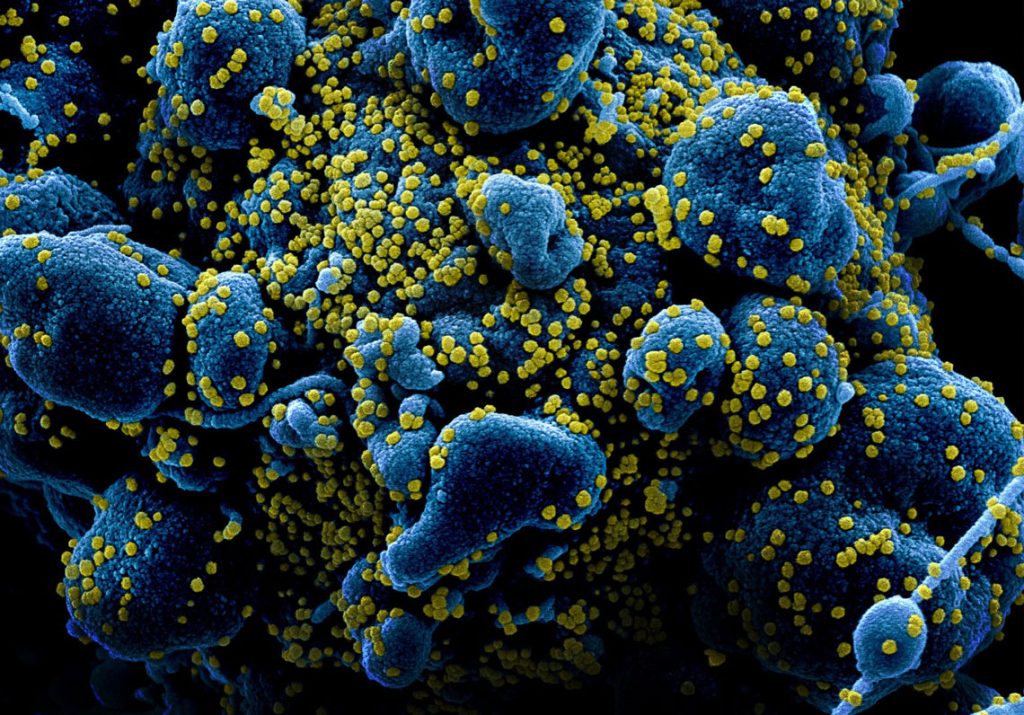coronavirus